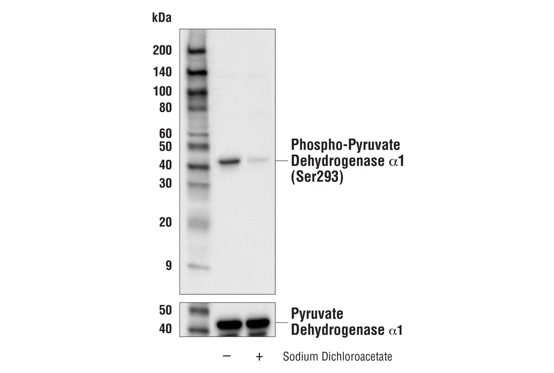 Western Blotting Image 2: Phospho-Pyruvate Dehydrogenase alpha1 (Ser293) (E4V9L) Rabbit Monoclonal Antibody (BSA and Azide Free)