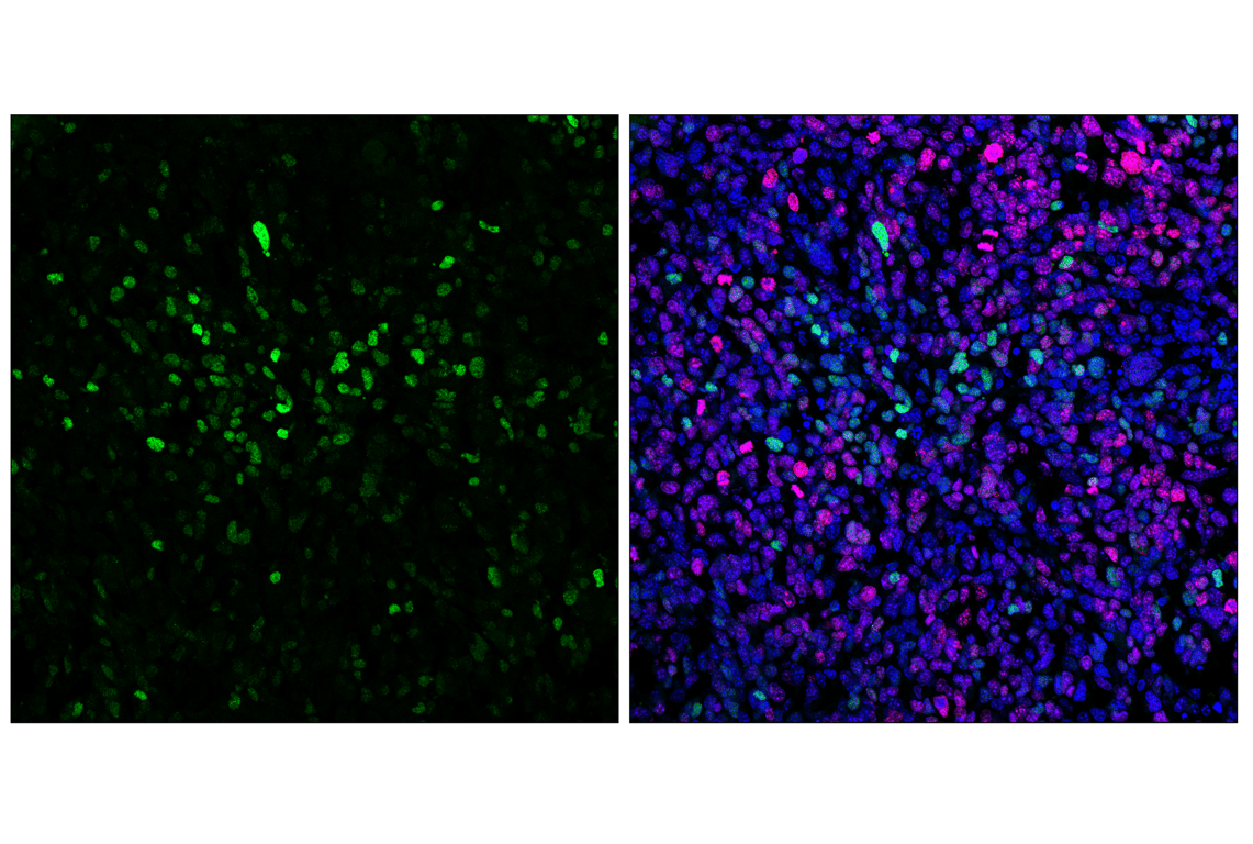 Immunofluorescence Image 1: p21 Waf1/Cip1 (F2C7C) Rabbit Monoclonal Antibody