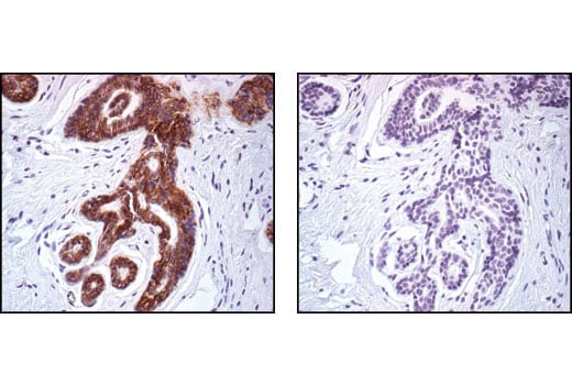 Immunohistochemistry Image 4: E-Cadherin Antibody