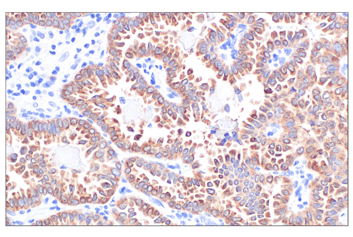 Immunohistochemistry Image 2: MGST1 (F6F5T) Rabbit Monoclonal Antibody
