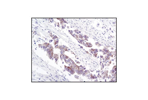 Immunohistochemistry Image 2: gamma-Catenin Antibody