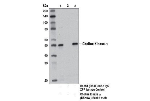 Immunoprecipitation Image 1: Choline Kinase alpha (D5X9W) Rabbit Monoclonal Antibody
