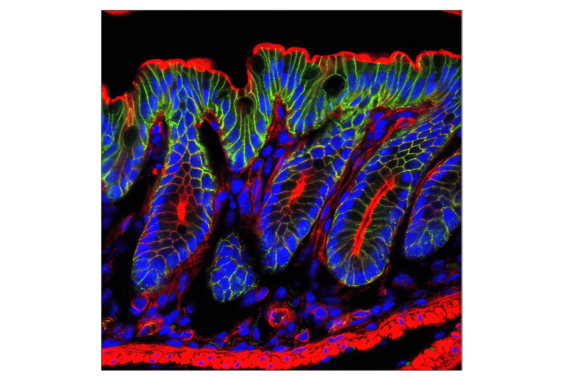 Immunofluorescence Image 1: beta-Catenin (D10A8) Rabbit Monoclonal Antibody