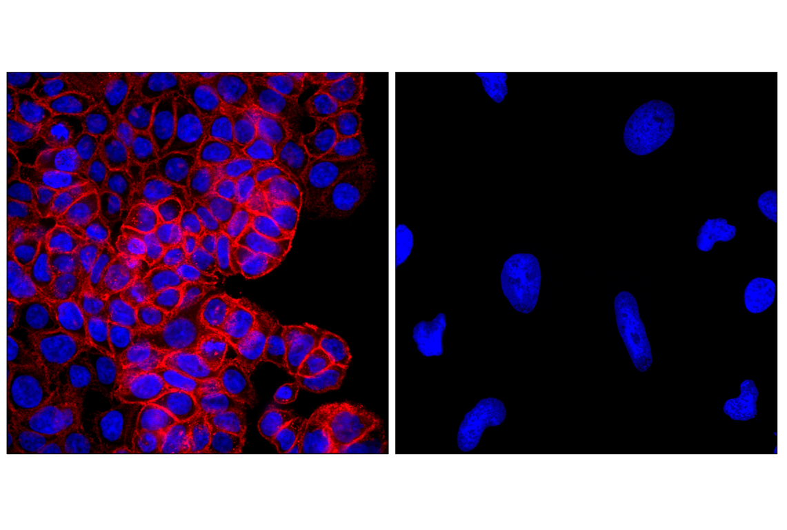 Immunofluorescence Image 2: EpCAM (VU1D9) Mouse Monoclonal Antibody (Alexa Fluor<sup>®</sup> 647 Conjugate)