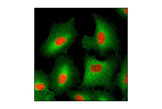 Immunofluorescence Image 1: HSP27 (G31) Mouse Monoclonal Antibody (BSA and Azide Free)
