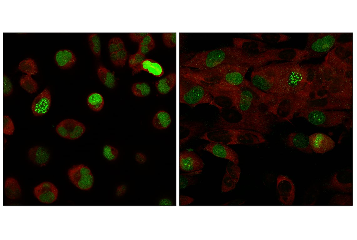 Immunofluorescence Image 1: SGO2 (E9K4N) Rabbit Monoclonal Antibody