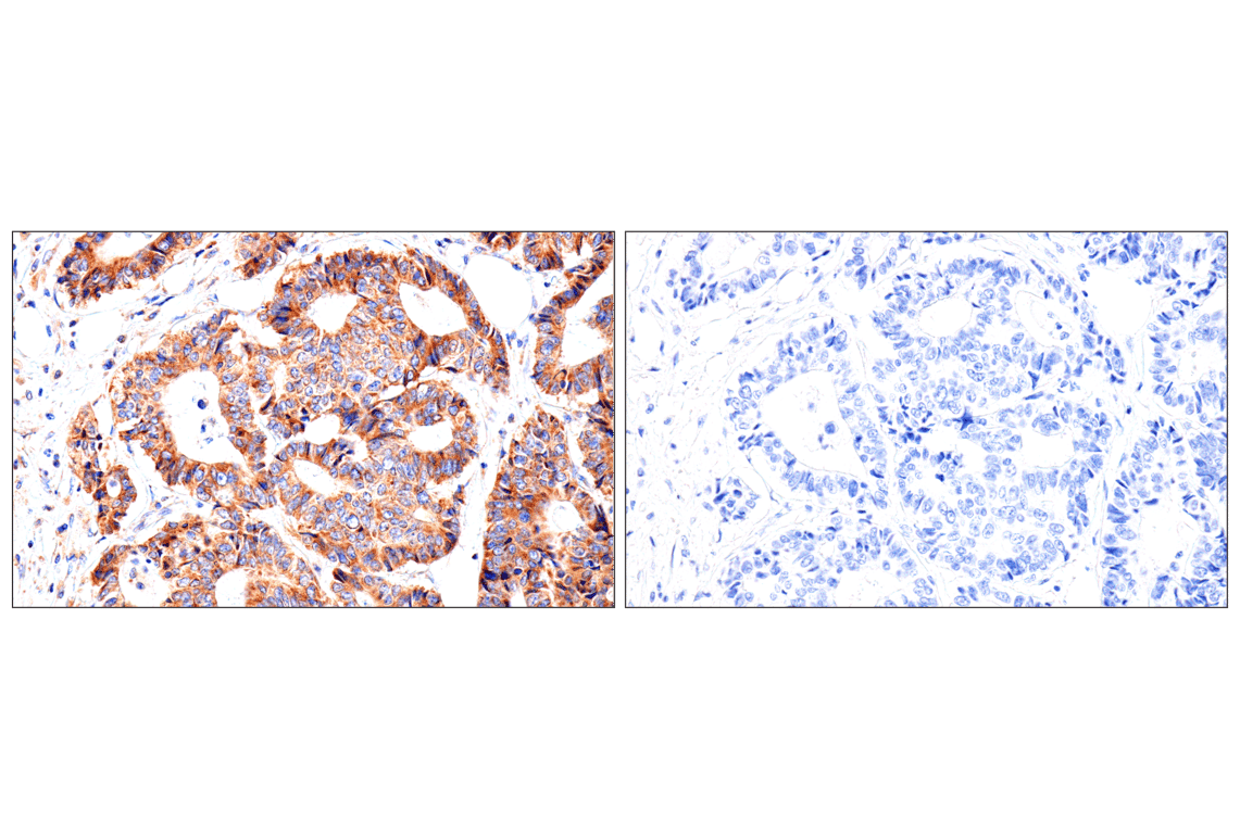 Immunohistochemistry Image 15: SLC25A1 (E7B2B) Rabbit Monoclonal Antibody