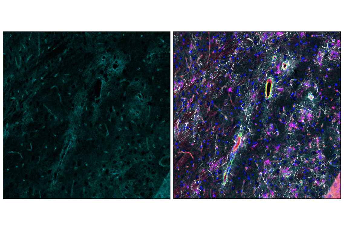 Immunofluorescence Image 4: AQP4 (D1F8E) Rabbit Monoclonal Antibody (Alexa Fluor<sup>®</sup> 647 Conjugate)