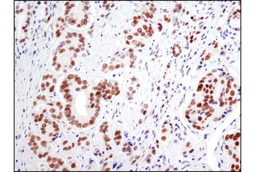 Immunohistochemistry Image 2: Androgen Receptor (D6F11) Rabbit Monoclonal Antibody