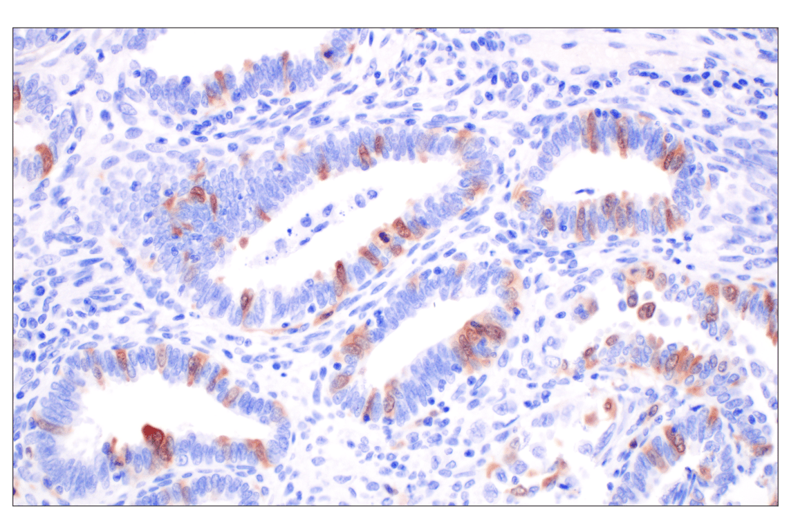 Immunohistochemistry Image 3: Thymidine Kinase 1 (E2H7Z) Rabbit Monoclonal Antibody