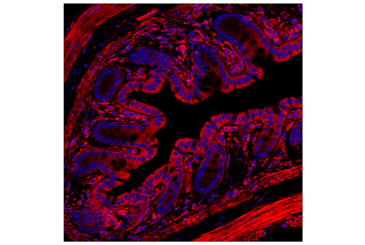 Immunofluorescence Image 2: Calpain 2 Large Subunit (M-type) (E3M6E) Rabbit Monoclonal Antibody