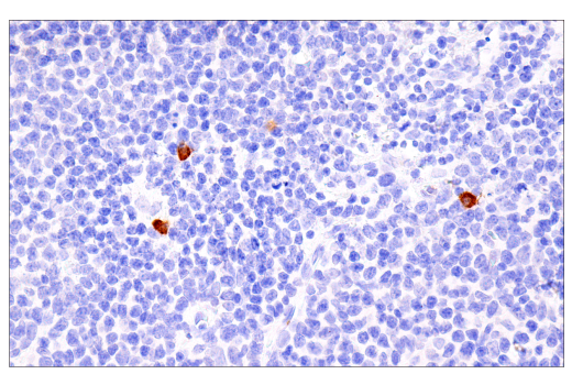 Immunohistochemistry Image 4: Rab27B (E4V3O) Rabbit Monoclonal Antibody