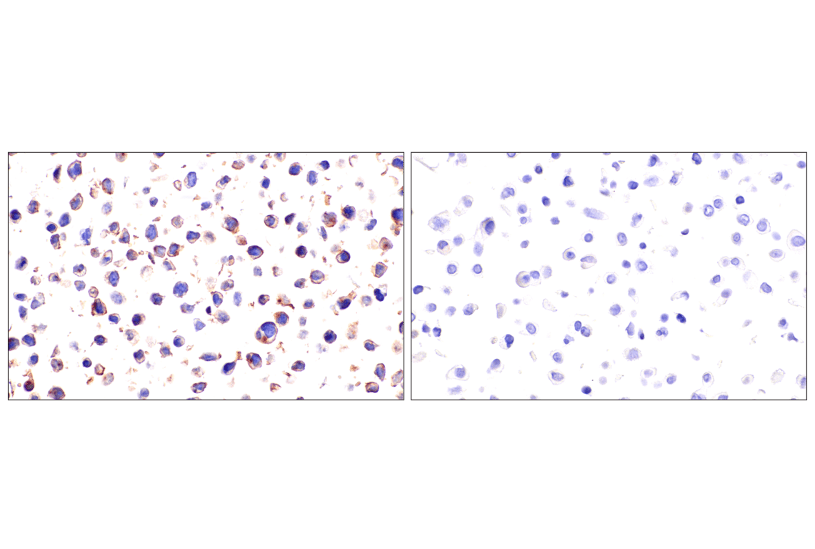 Immunohistochemistry Image 10: Semaphorin-4A (E5N3K) Rabbit Monoclonal Antibody (BSA and Azide Free)