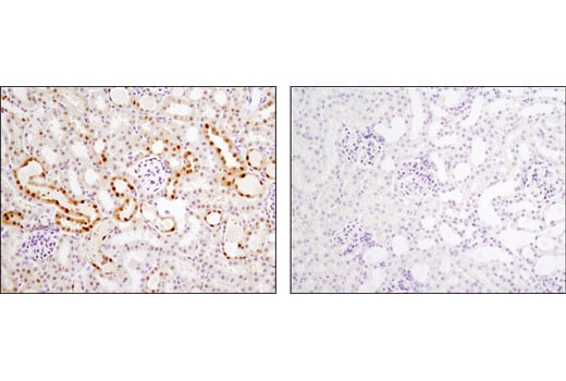 Immunohistochemistry Image 3: Vitamin D3 Receptor (D2K6W) Rabbit Monoclonal Antibody (BSA and Azide Free)