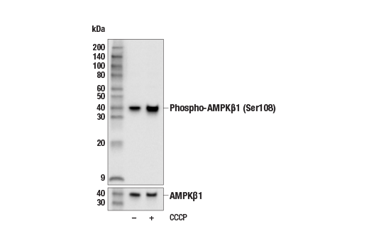 Western Blotting Image 2: Phospho-AMPK beta1 (Ser108) (E8N3N) Rabbit Monoclonal Antibody