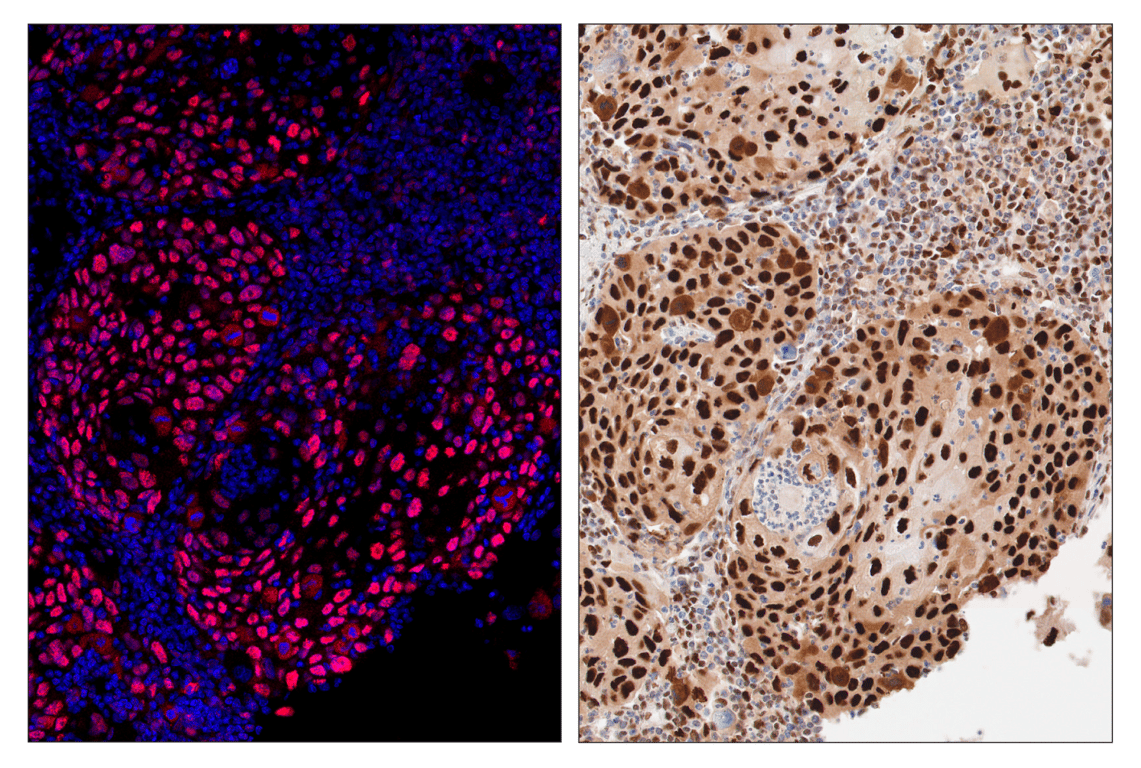 Immunohistochemistry Image 4: PCNA (D3H8P) & CO-0090-647 SignalStar<sup>™</sup> Oligo-Antibody Pair