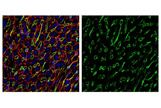 CD206/MRC1 (E6T5J) XP® Rabbit mAb (#24595) Datasheet With