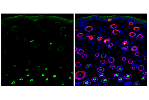 Immunofluorescence Image 1: Pan-Keratin (C11) Mouse Monoclonal Antibody (Alexa Fluor<sup>®</sup> 488 Conjugate)