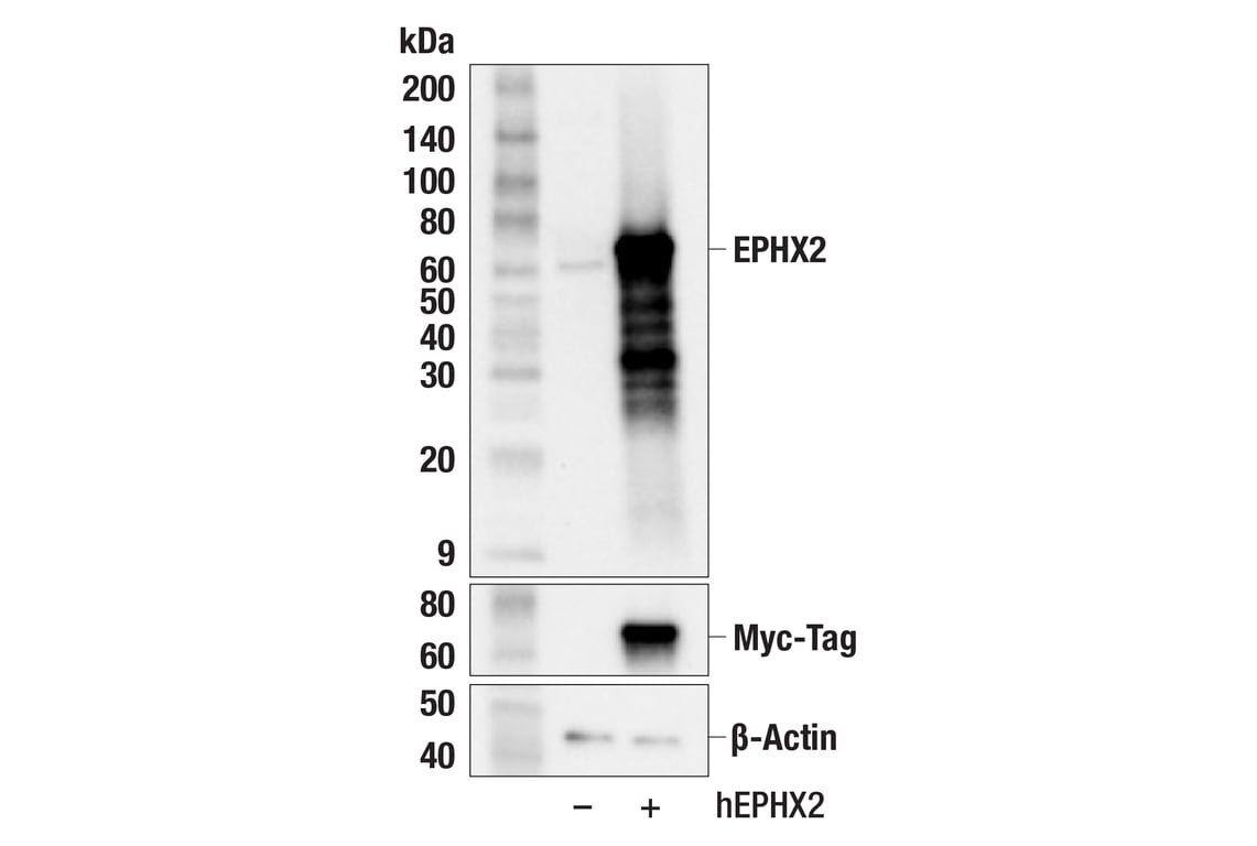 Western Blotting Image 2: EPHX2 (F9Z3M) Rabbit Monoclonal Antibody