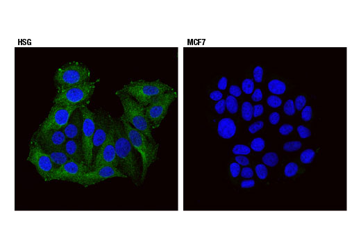 Immunofluorescence Image 1: Endophilin-1 (E1E6Q) Rabbit Monoclonal Antibody