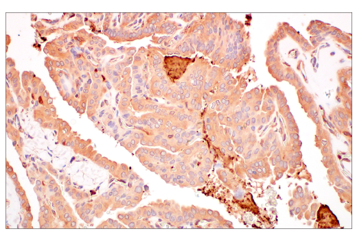 Immunohistochemistry Image 5: ILK1 (4G9) Rabbit Monoclonal Antibody