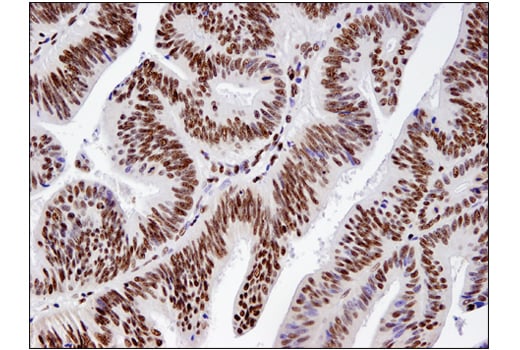 Immunohistochemistry Image 2: BRM (D9E8B) XP<sup>®</sup> Rabbit mAb