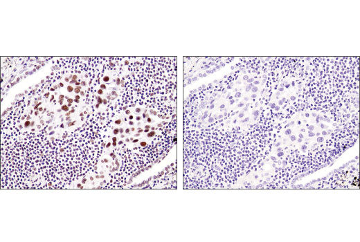 Immunohistochemistry Image 5: SMARCB1/BAF47 (D8M1X) Rabbit mAb