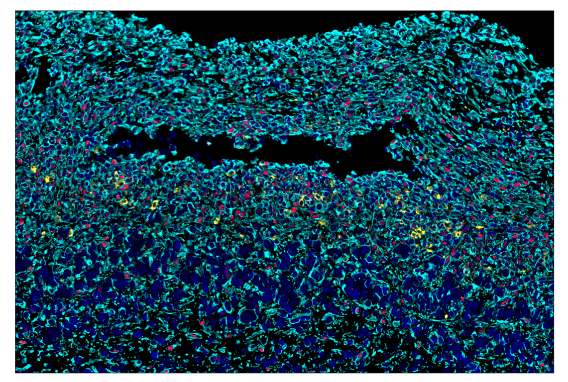 Immunohistochemistry Image 6: Phospho-Stat3 (Tyr705) (D3A7) & CO-0029-488 SignalStar<sup>™</sup> Oligo-Antibody Pair