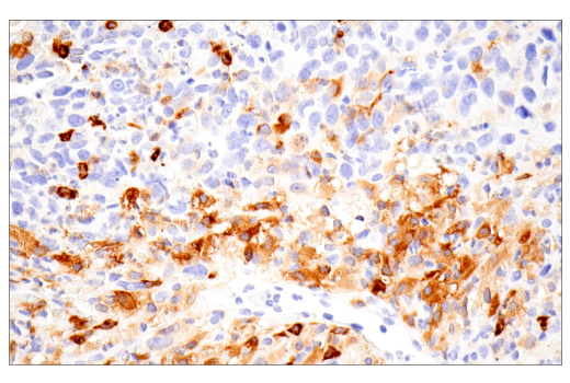 Immunohistochemistry Image 1: iNOS (E1W4J) Rabbit Monoclonal Antibody