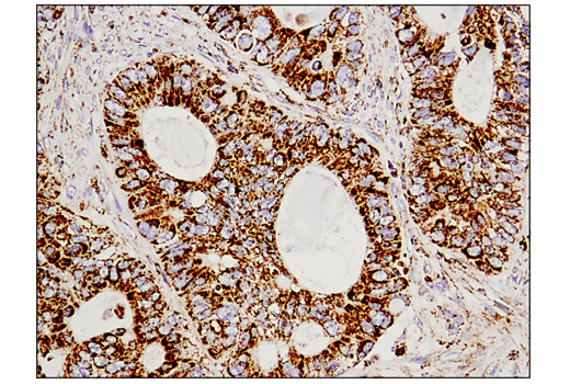 Immunohistochemistry Image 2: Malic Enzyme 2 (E1N3E) Rabbit Monoclonal Antibody