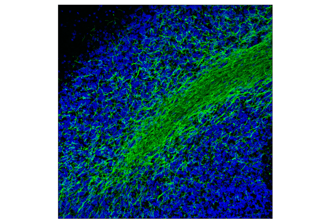 undefined Image 10: Demyelinating Disease Targets Antibody Sampler Kit