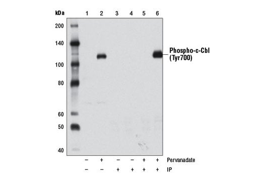 undefined Image 25: Phospho-EGF Receptor Pathway Antibody Sampler Kit