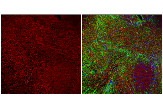 Immunofluorescence Image 2: Neurofilament-H (E7Z7G) Rabbit Monoclonal Antibody