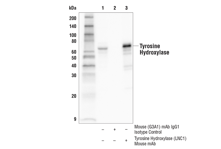 Immunoprecipitation Image 1: Tyrosine Hydroxylase (LNC1) Mouse Monoclonal Antibody