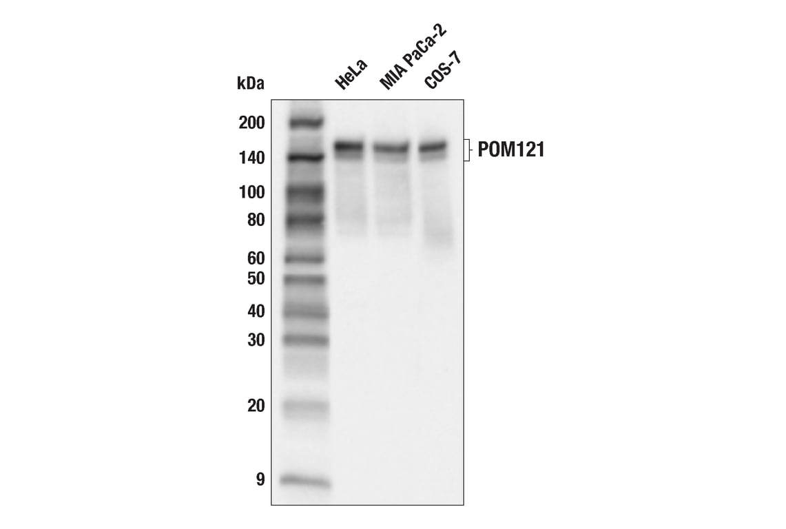 Western Blotting Image 2: POM121 (E3W3J) Rabbit Monoclonal Antibody