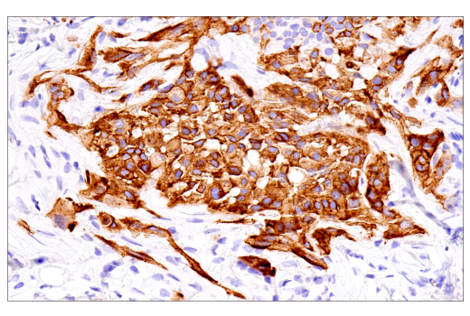 undefined Image 35: SARS-CoV-2 Virus-Host Interaction Antibody Sampler Kit