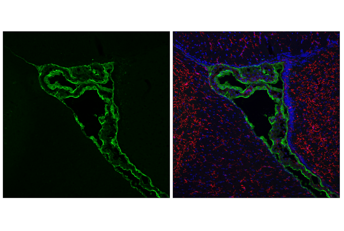 Immunofluorescence Image 1: SPAK (F7T1K) Rabbit Monoclonal Antibody