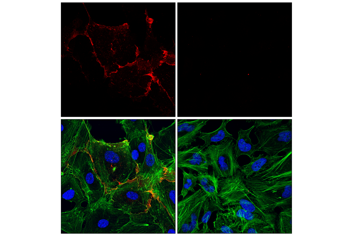 Immunofluorescence Image 1: CD31 (PECAM-1) (89C2) Mouse Monoclonal Antibody (Alexa Fluor<sup>®</sup> 555 Conjugate)