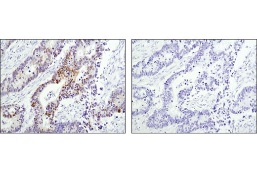 Immunohistochemistry Image 3: Wee1 (D10D2) Rabbit Monoclonal Antibody