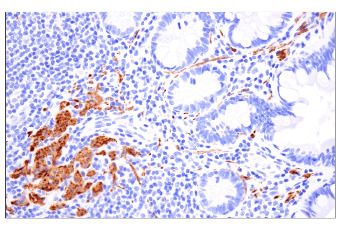 Immunohistochemistry Image 8: Desmin (F5V4I) Rabbit Monoclonal Antibody (BSA and Azide Free)