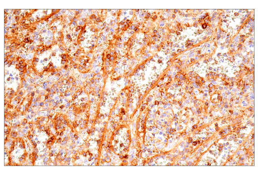 Immunohistochemistry Image 10: CD99 (PCB1) Mouse Monoclonal Antibody