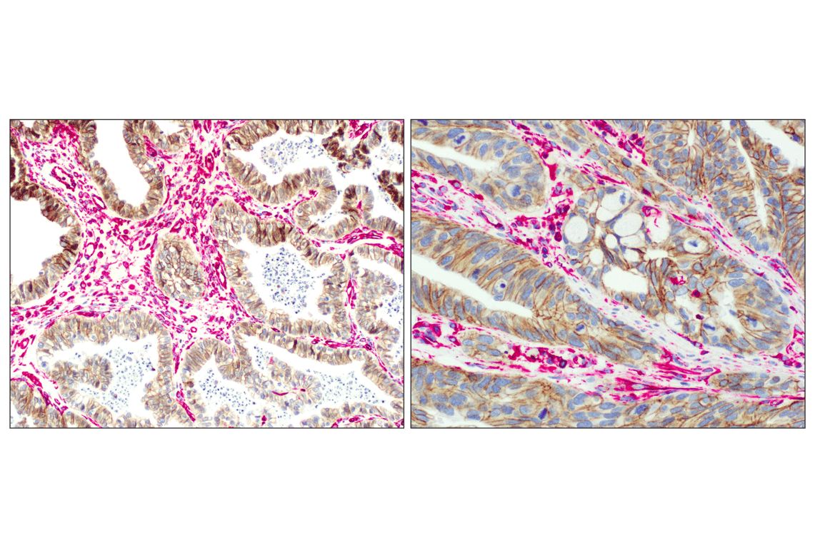 Immunohistochemistry Image 3: SignalStain<sup>®</sup> Boost IHC Detection Reagent (AP, Rabbit)