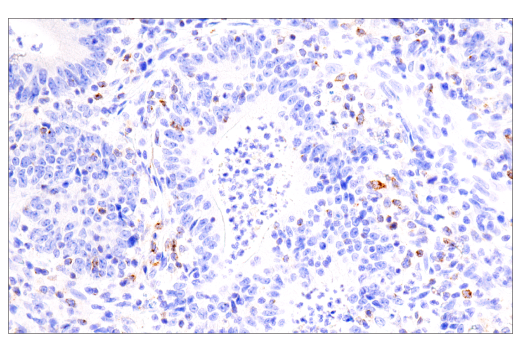 Immunohistochemistry Image 1: CTLA-4 (E2V1Z) Rabbit Monoclonal Antibody (BSA and Azide Free)