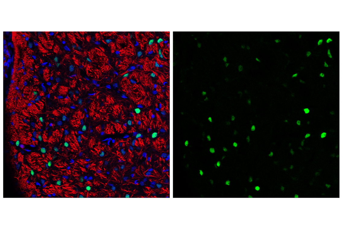 Immunofluorescence Image 2: c-Fos (9F6) Rabbit Monoclonal Antibody