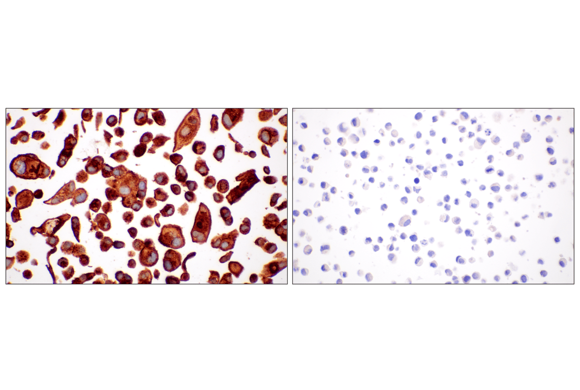Immunohistochemistry Image 12: LY6E (F8Y1R) Rabbit Monoclonal Antibody