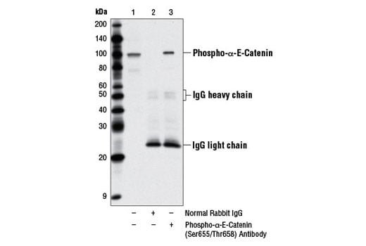 Immunoprecipitation Image 1: Phospho-alpha-E-Catenin (Ser655/Thr658) Antibody
