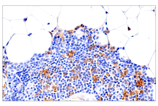 Immunohistochemistry Image 6: GM-CSF Receptor alpha (E8Z3S) Rabbit Monoclonal Antibody (BSA and Azide Free)