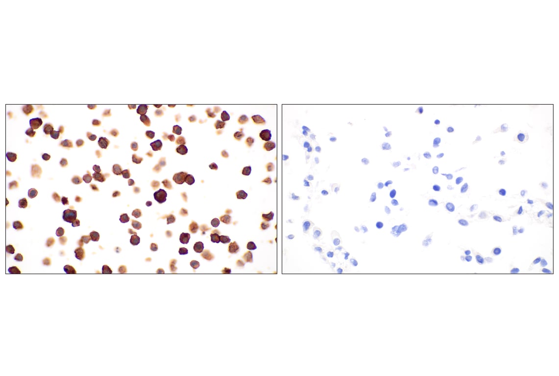 Immunohistochemistry Image 12: CD11b/ITGAM (E4K8C) Rabbit Monoclonal Antibody