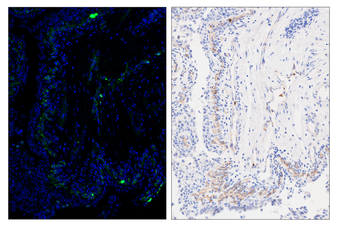 Immunohistochemistry Image 3: MMP-9 (D6O3H) & CO-0142-647 SignalStar<sup>™</sup> Oligo-Antibody Pair