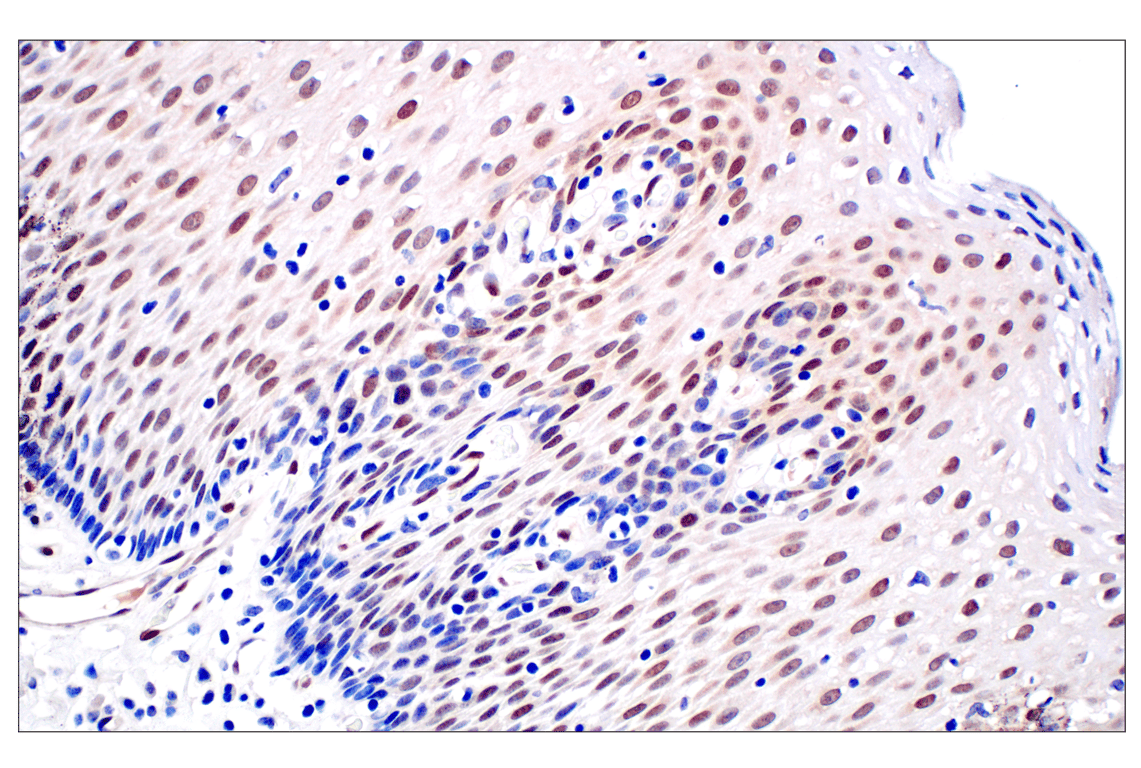 Immunohistochemistry Image 6: ID1 (F2M1J) Rabbit Monoclonal Antibody (BSA and Azide Free)